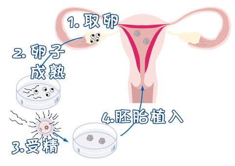 试管借卵代怀机构